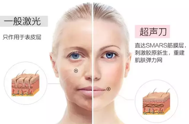 QQ图片20160315161220.png
